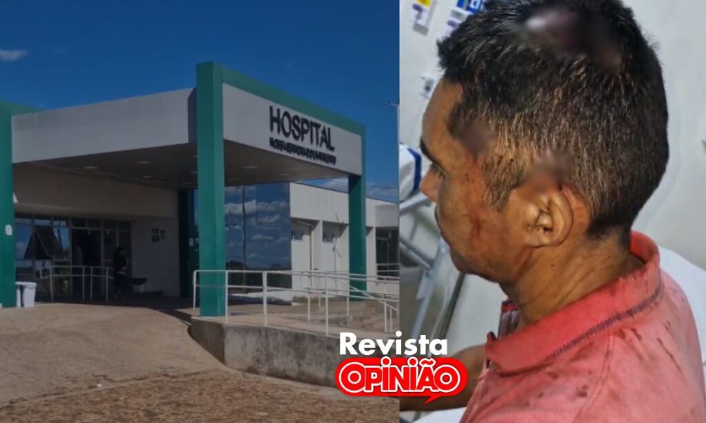 Comerciante tem braço quebrado e sofre lesão na cabeça durante assalto em José de Freitas 1 Assanto Comerciante 2