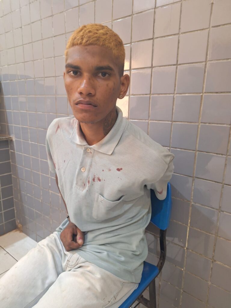 Comerciante tem braço quebrado e sofre lesão na cabeça durante assalto em José de Freitas 2 WhatsApp Image 2025 07 14 at 18.59.37